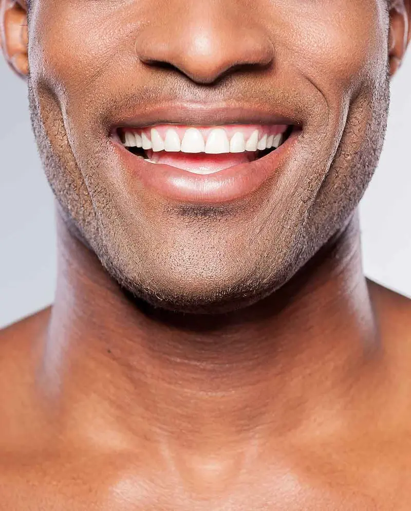 Patient with a bright white smile after professional teeth whitening at Elite Boca Dental