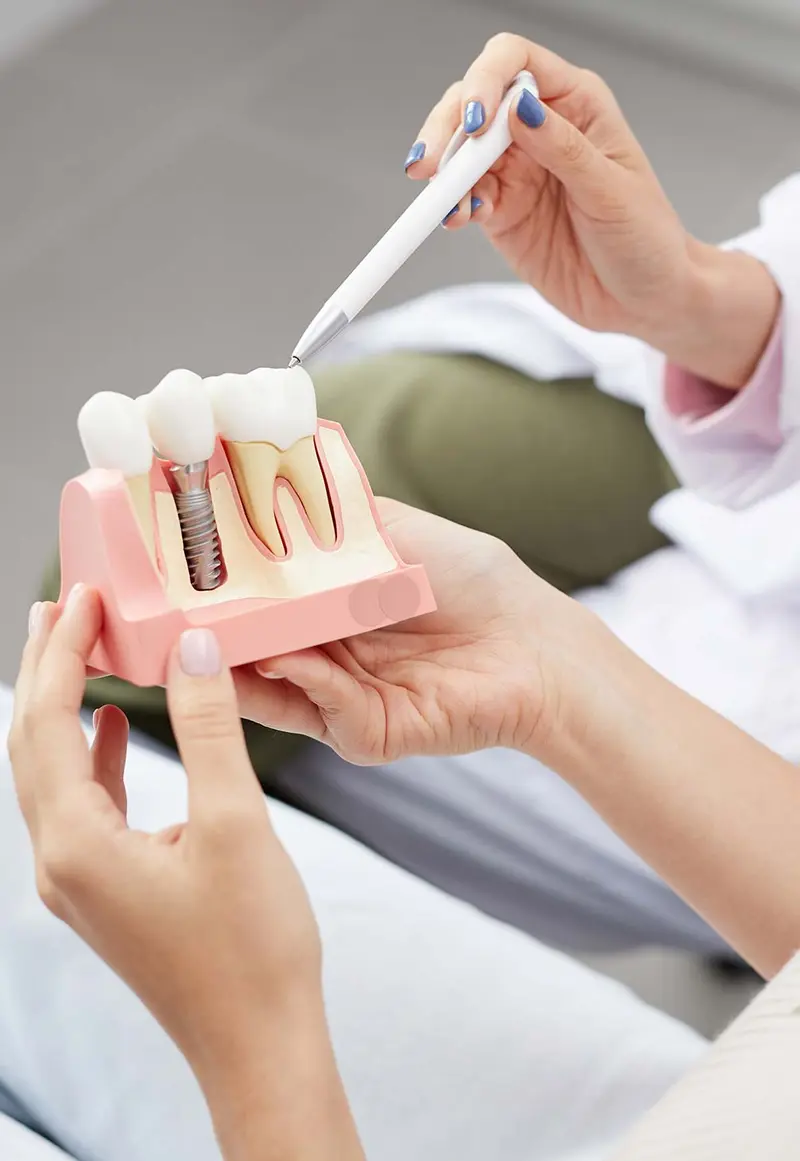 Dental model of teeth, gums, and bone held during a patient consultation at Elite Boca Dental