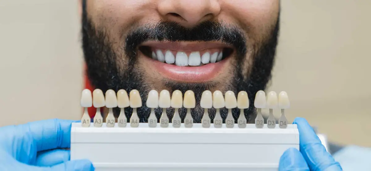 Close view of a bright, even smile created with porcelain veneers at Elite Boca Dental